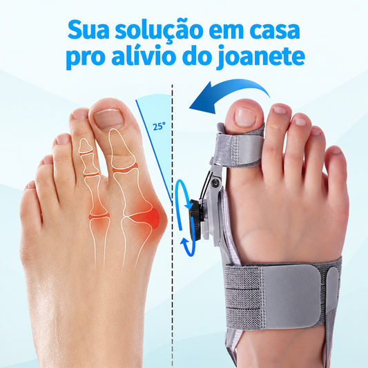 Corretor de joanete Ortevi no pé, puxando o dedão de volta pra posição natural