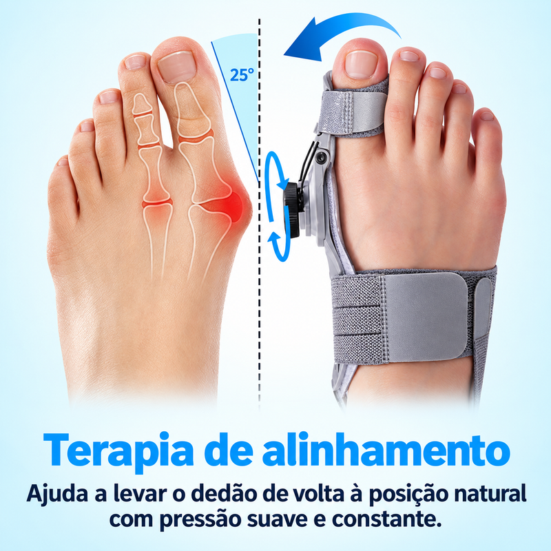 Terapia de alinhamento: ajuda a levar o dedão de volta à posição natural com pressão suave e constante